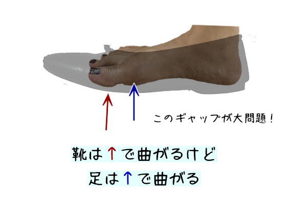 ボールジョイント