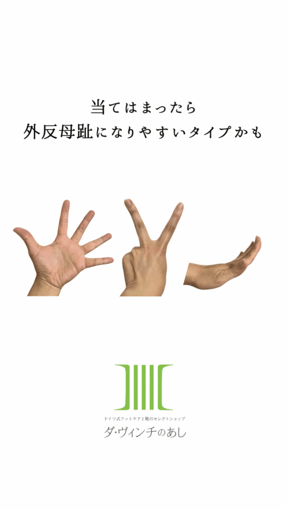ダ・ヴィンチのあし,巻き爪,手術,名医,熊本,副爪, 小指の爪,ボロボロ