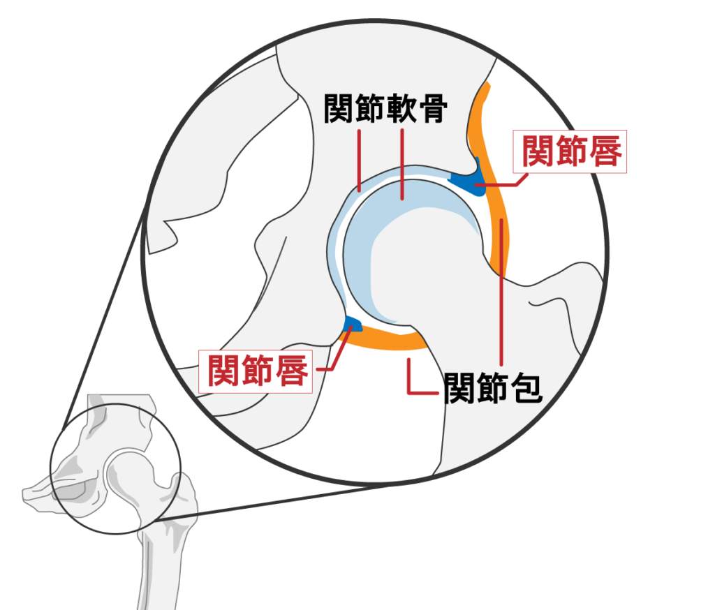 股関節の構造を示す図。骨盤のくぼみ（臼蓋）に大腿骨頭がはまり込んだボールとソケットの仕組み